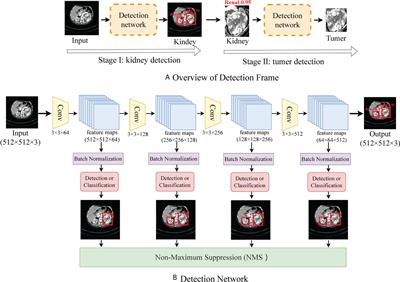 CT-based transformer model for non-invasively predicting the Fuhrman nuclear grade of clear cell renal cell carcinoma